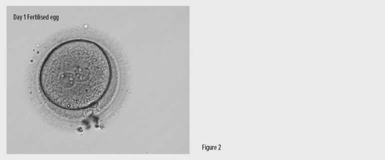 Icsi Fig2 Desktop Life Fertility Clinic